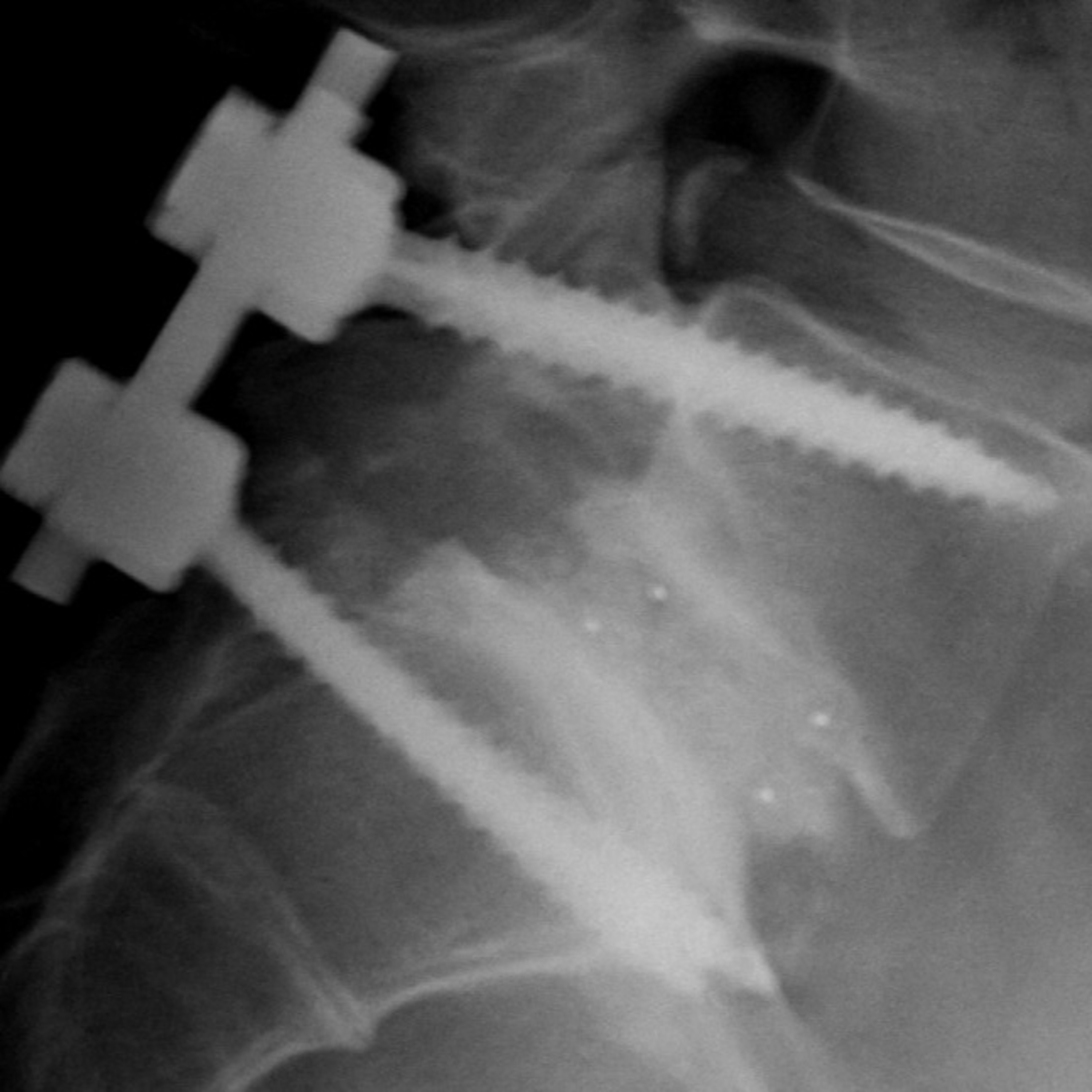 Tapping In Ep 11: Dealing with Injuries